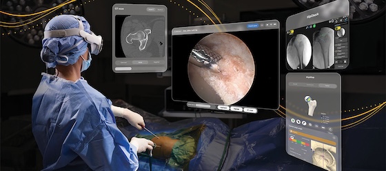 FDA greenlights Stryker's surgical display system built for Apple Vision Pro