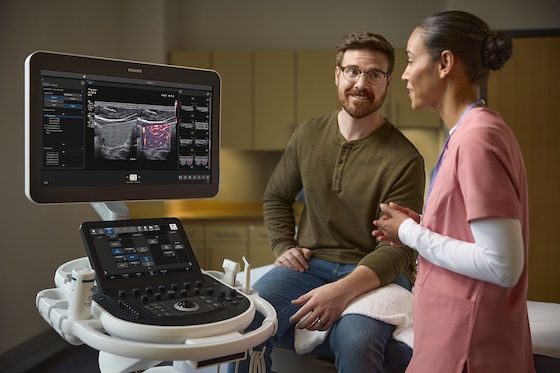 Philips rolls out AI-powered ultrasound system to tackle high patient volumes