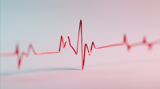 ESC26: Wearable ECG more than doubles arrhythmia detection after unexplained fainting