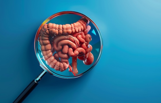 Abivax colitis drug hits goal, but cancer cases rattle investors