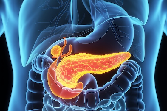 ASCO26: Amid daraxonrasib spotlight, Immuneering makes case for its drug in 1L pancreatic cancer