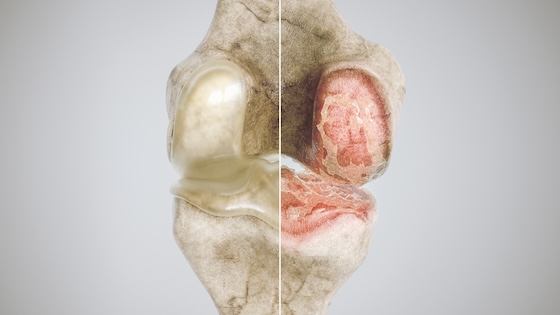Kolon's cell-based gene therapy faces another test after Phase III letdown