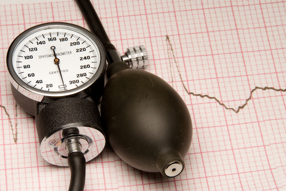 Sky Labs ring could help track blood pressure in harder-to-monitor heart patients