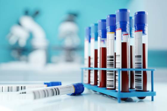 ASCO26: ClearNote Health's blood test spots early pancreatic cancer in high-risk groups