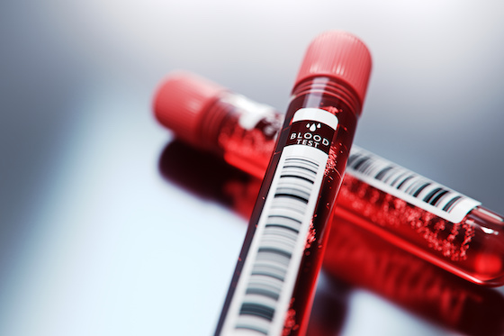SOPHiA GENETICS taps Synnovis to bring AI blood test to UK cancer patients