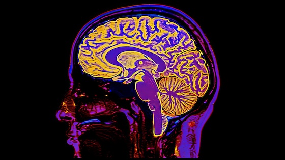 Axoltis touts secondary findings after ALS hopeful misses its main mark