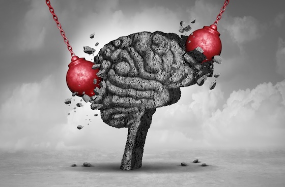Kallyope's neurology reboot hits snag after migraine study stoppage | FirstWord Pharma Kallyope's neurology reboot hits snag after migraine study stoppage | FirstWord Pharma