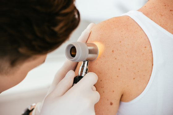 Regeneron's LAG-3 inhibitor combo falls short in late-stage melanoma study