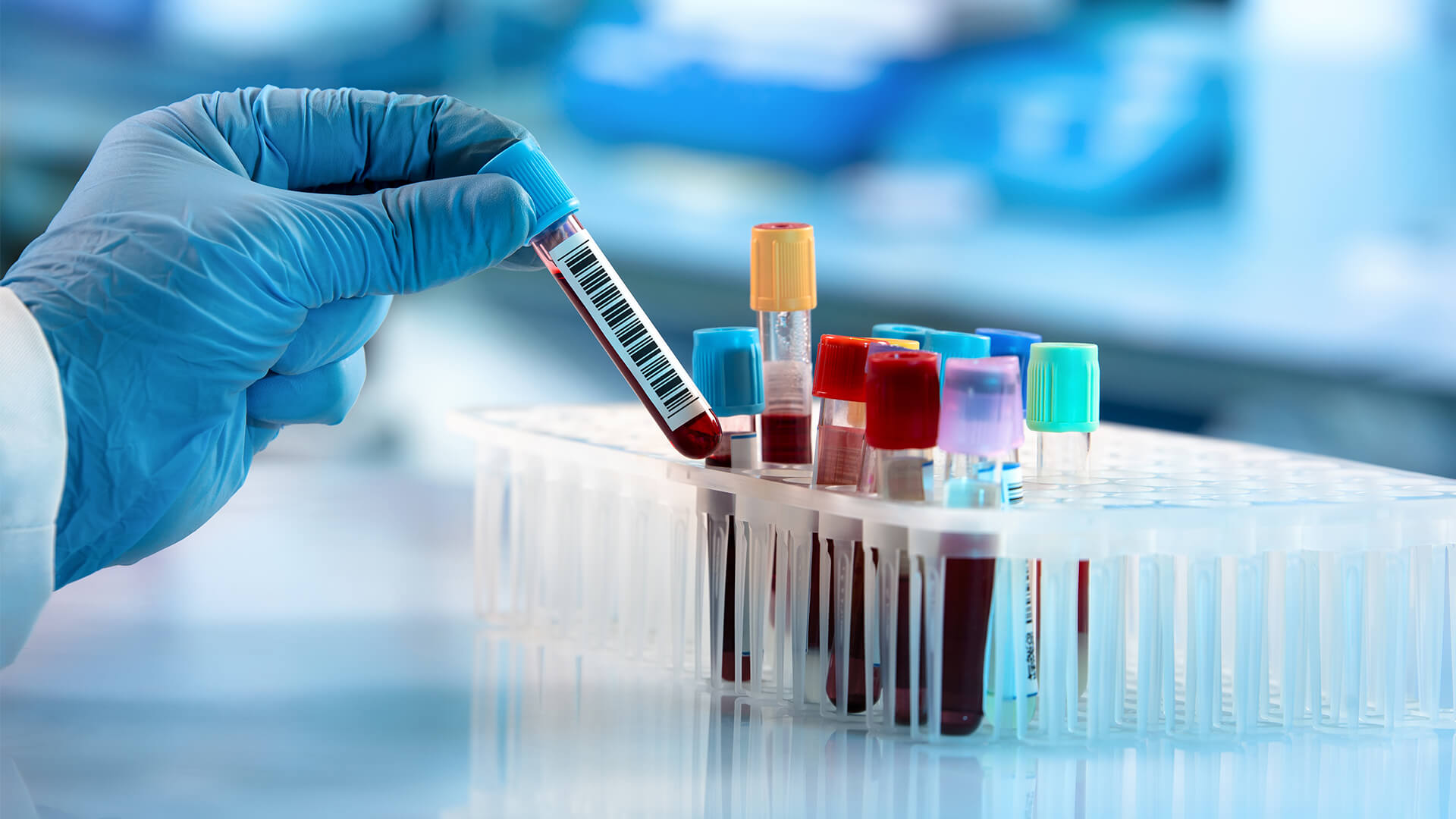 AI-powered blood test diagnoses paediatric long COVID-19 with 93% accuracy:  study