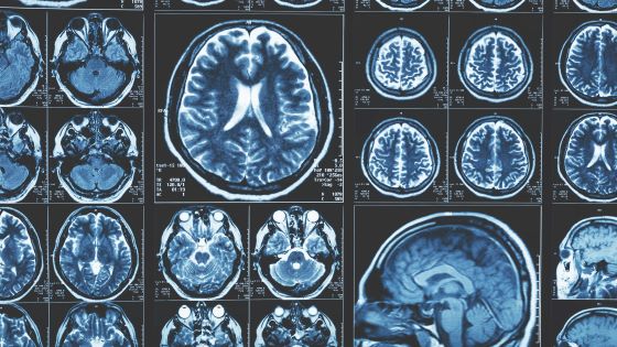 Lilly Partners With Entos On Nucleic Acid Drugs For Neurologic Indications