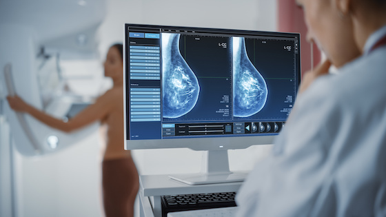 Roche inks $490M+ breast cancer therapeutics deal with Otsuka's Astex