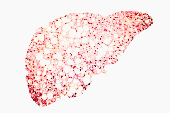 tirzepatide mash South Korean biotech touts 'remarkably positive' results for MASH contender
